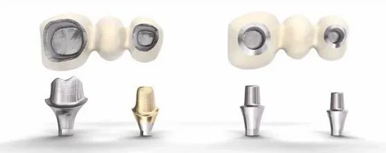 implant abutment implant abutment